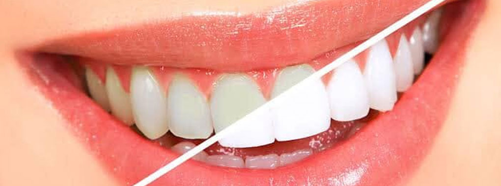 Dental Point