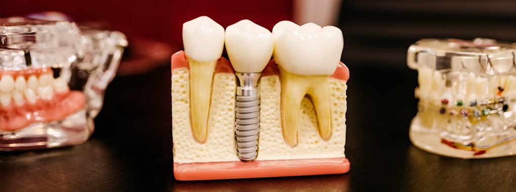 Dental Point
