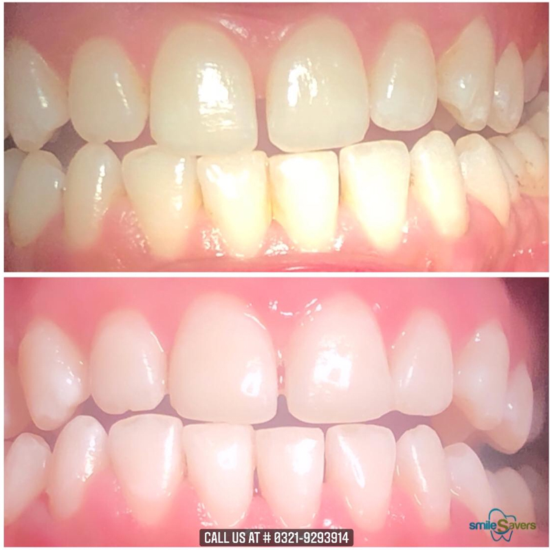 Smile Savers photo 2
