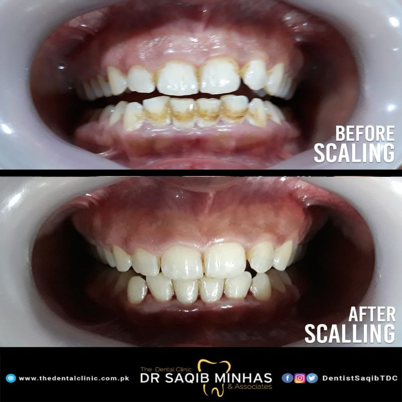 The Dental Clinic by Dr. Saqib Minhas photo 1